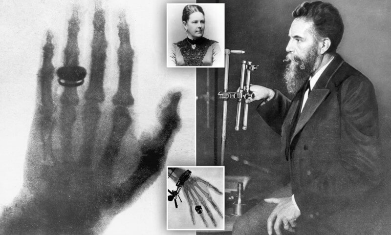 Wilhelm Conrad Röntgen padre de la radiología