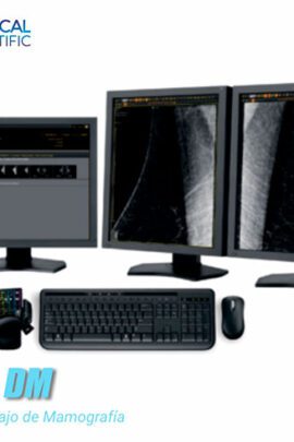 Estación de Trabajo de Mamografía DIARM DM desarrollada por Medical Scientific