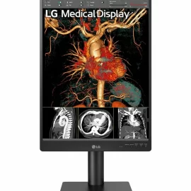 Monitor de Diagnóstico LG 21.3" 3MP modelo 21HQ513D (Diagnóstico General)