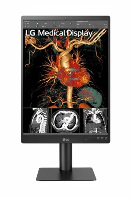Monitor de Diagnóstico LG 21.3" 3MP modelo 21HQ513D (Diagnóstico General)