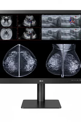 Monitor de Diagnóstico LG 31" 12MP modelo 31HN713D (Mamografía)