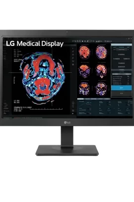 Monitor de Revisión Clínica LG 24" 2MP modelo24HR513C (Revisión Clínica)