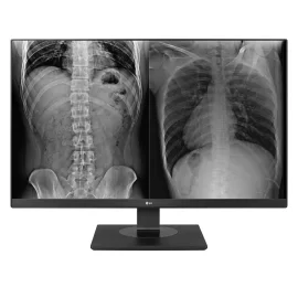 Monitor de Revisión Clínica LG 27" 8MP modelo 27HJ713C (Revisión Clínica)