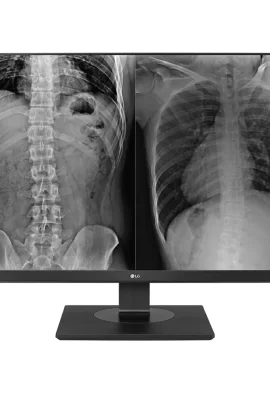 Monitor de Revisión Clínica LG 27" 8MP modelo 27HJ713C (Revisión Clínica)