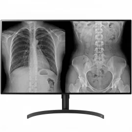 Monitor Diagnóstico LG 32HL512D - Alta Precisión en Imágenes Médicas de 8MP (Diagnóstico General)