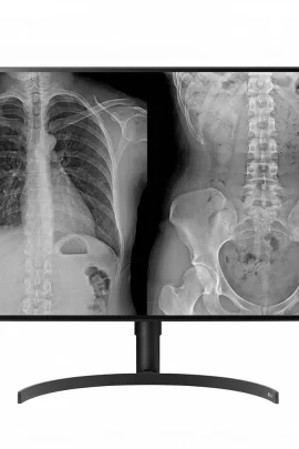 Monitor Diagnóstico LG 32HL512D - Alta Precisión en Imágenes Médicas de 8MP (Diagnóstico General)